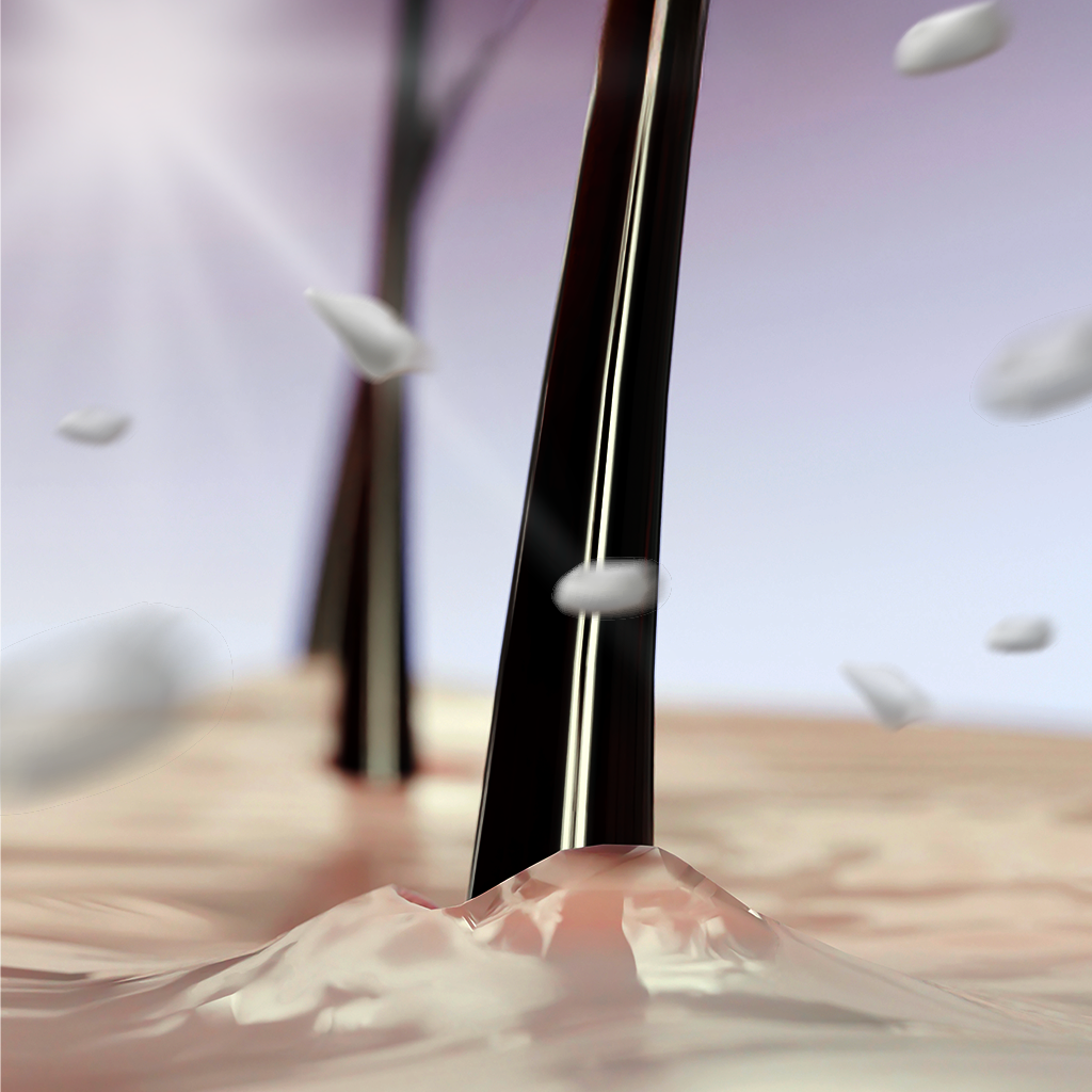 The Real Reasons Behind Scalp Changes (Part II)