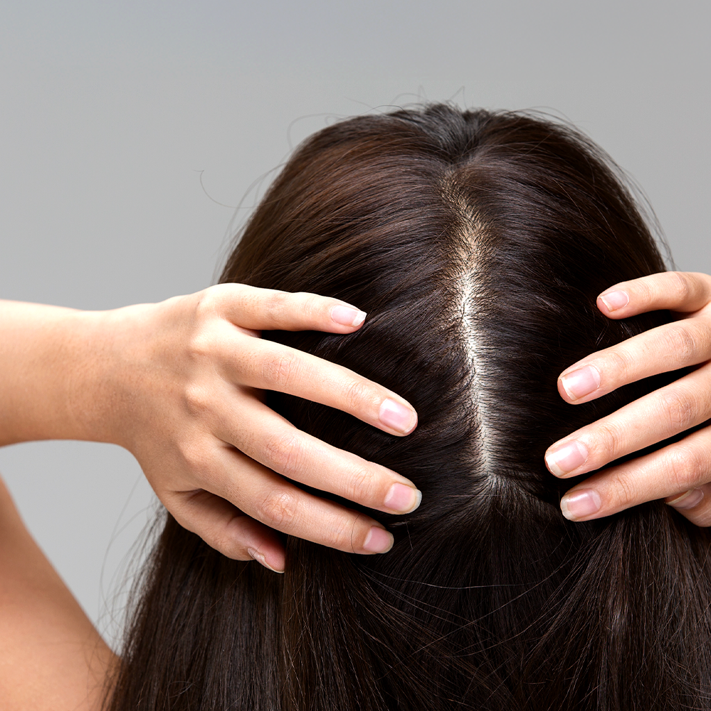 What is your scalp type?